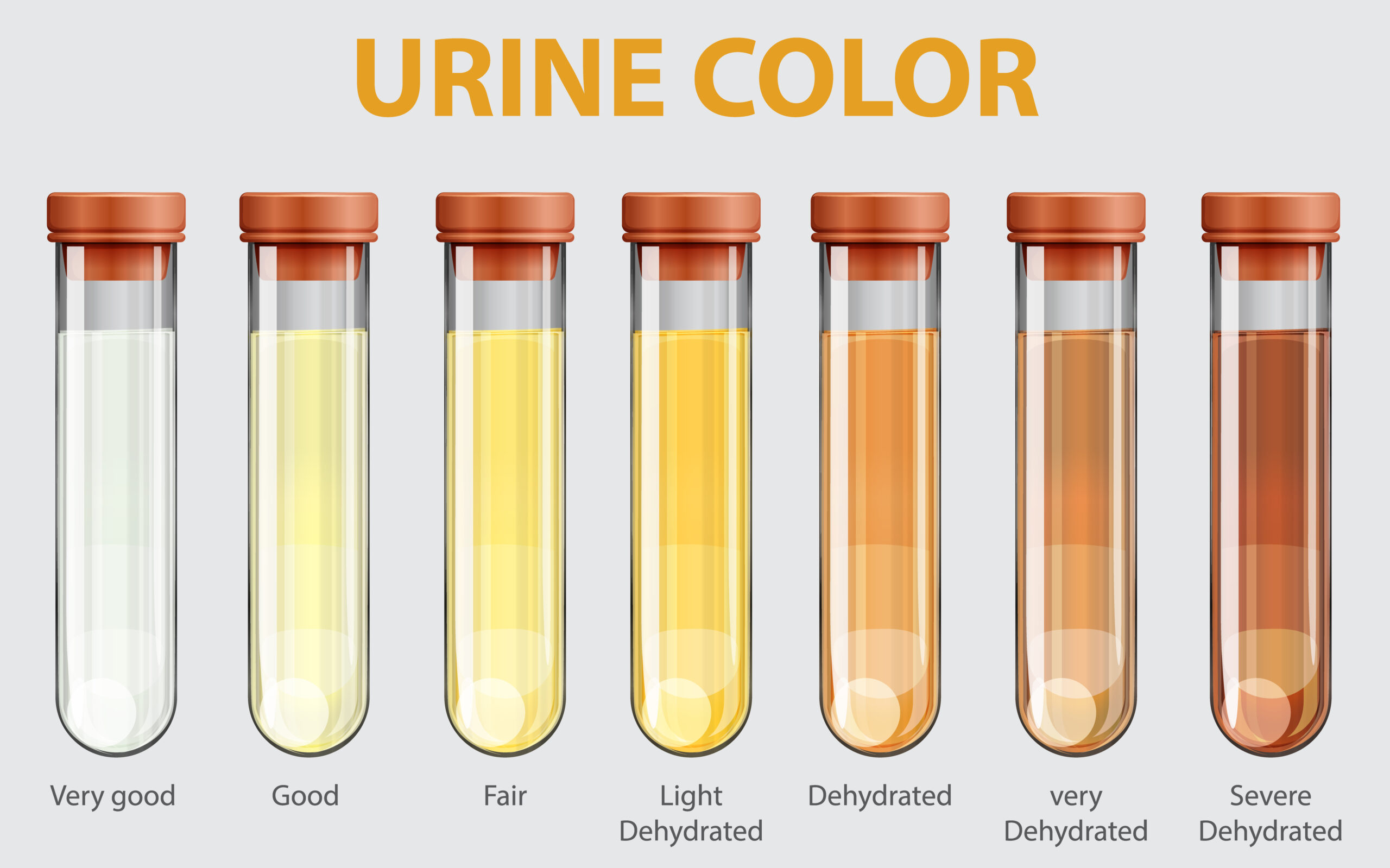 7 Urine Colors: A Comprehensive Guide to Normalcy and When to Seek Medical Attention