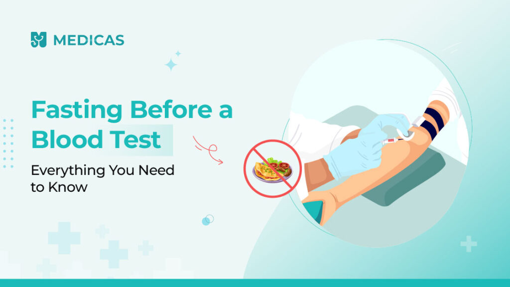 fasting before blood test