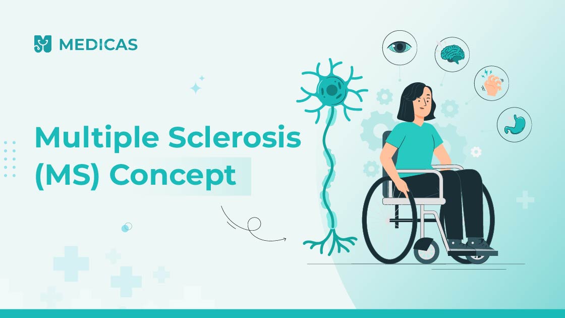 Multiple Sclerosis