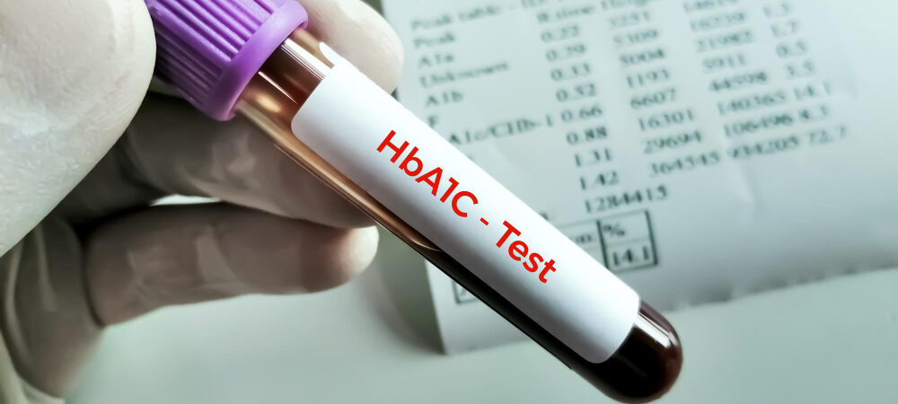 blood-sample-hba1c