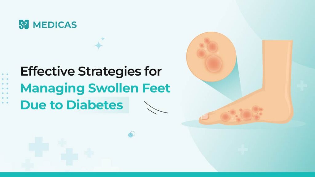 diabetes foot