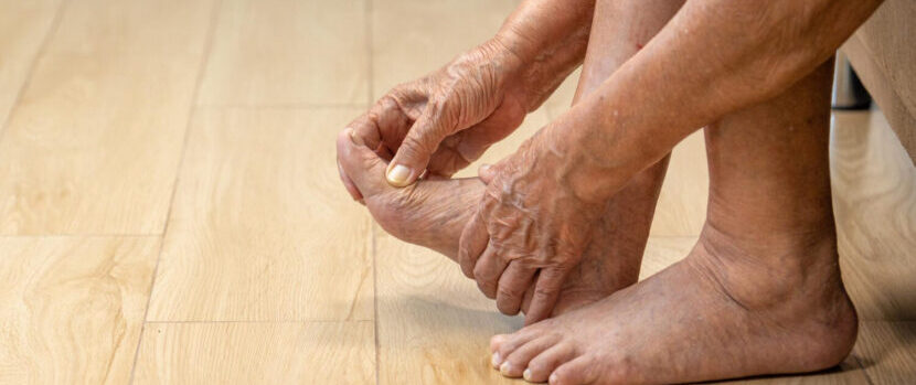 Effective Strategies for Managing Swollen Feet Due to Diabetes