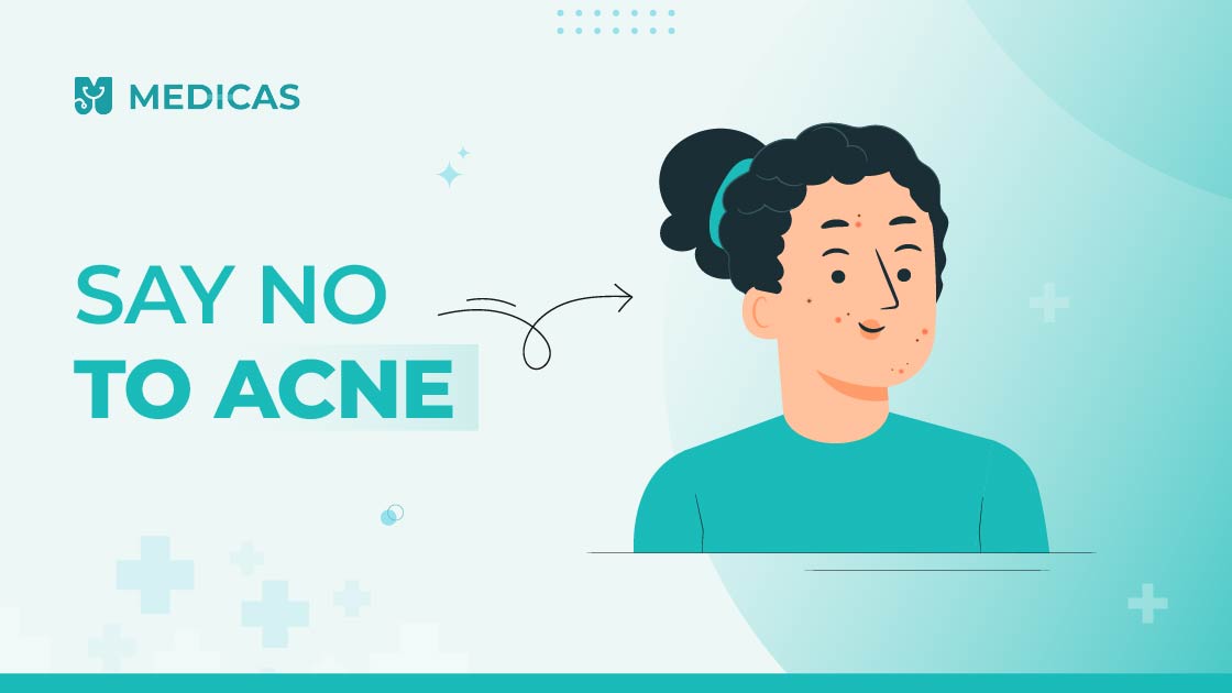 Acne treatment