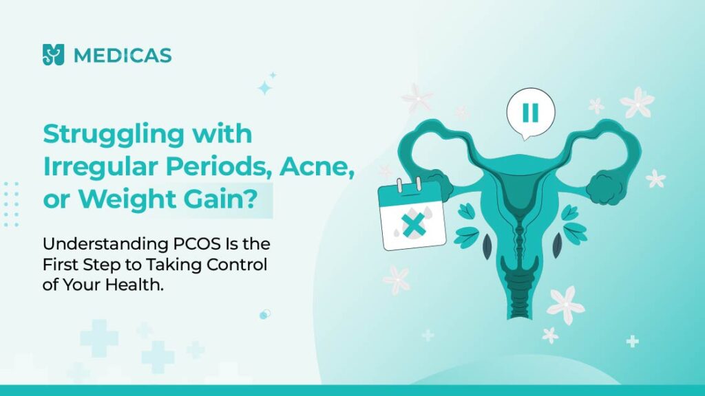 Understanding PCOS
