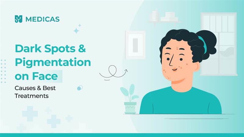 dark spots on face