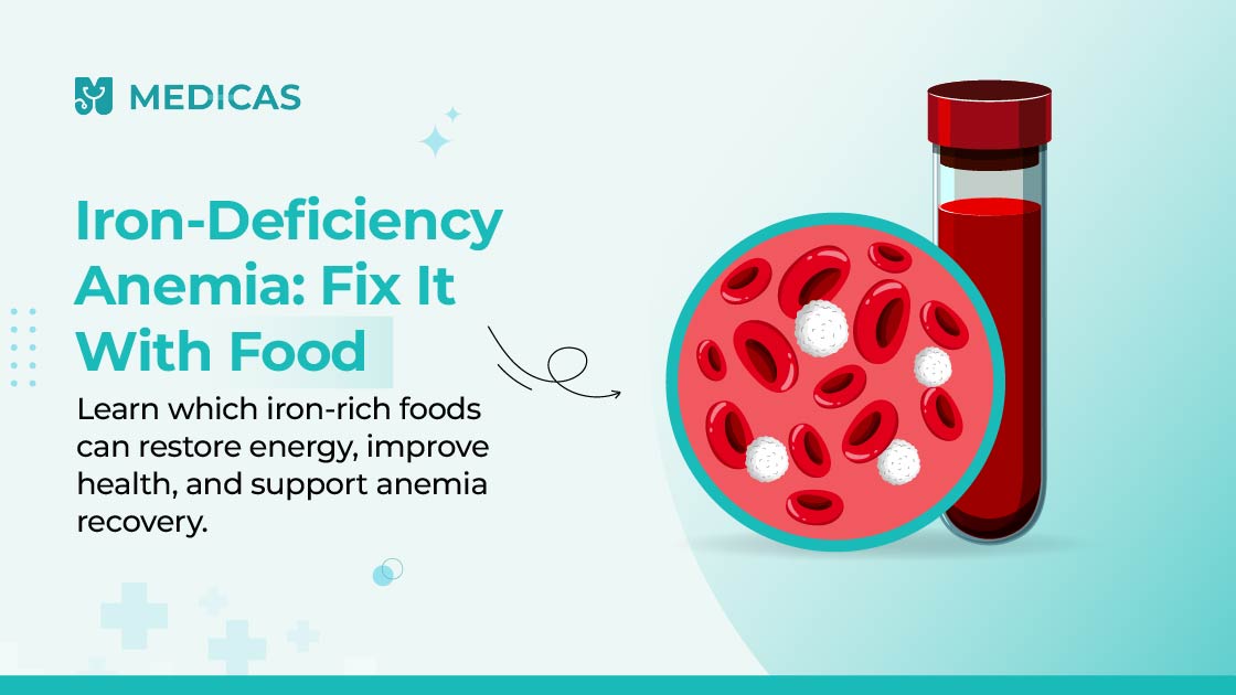 iron deficiency anemia diet