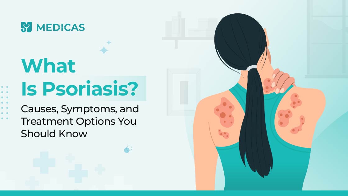 psoriasis