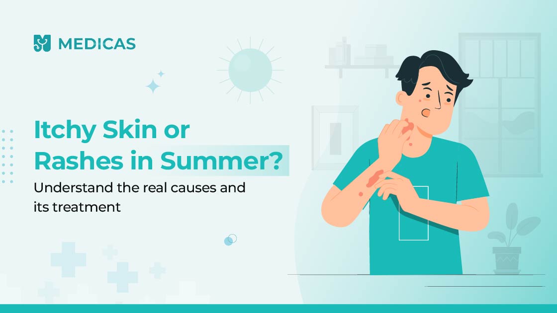 itchy skin