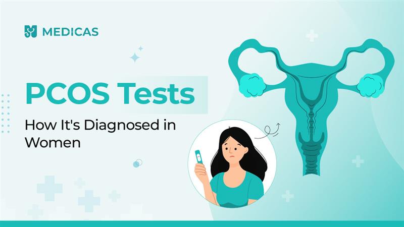 PCOS Test