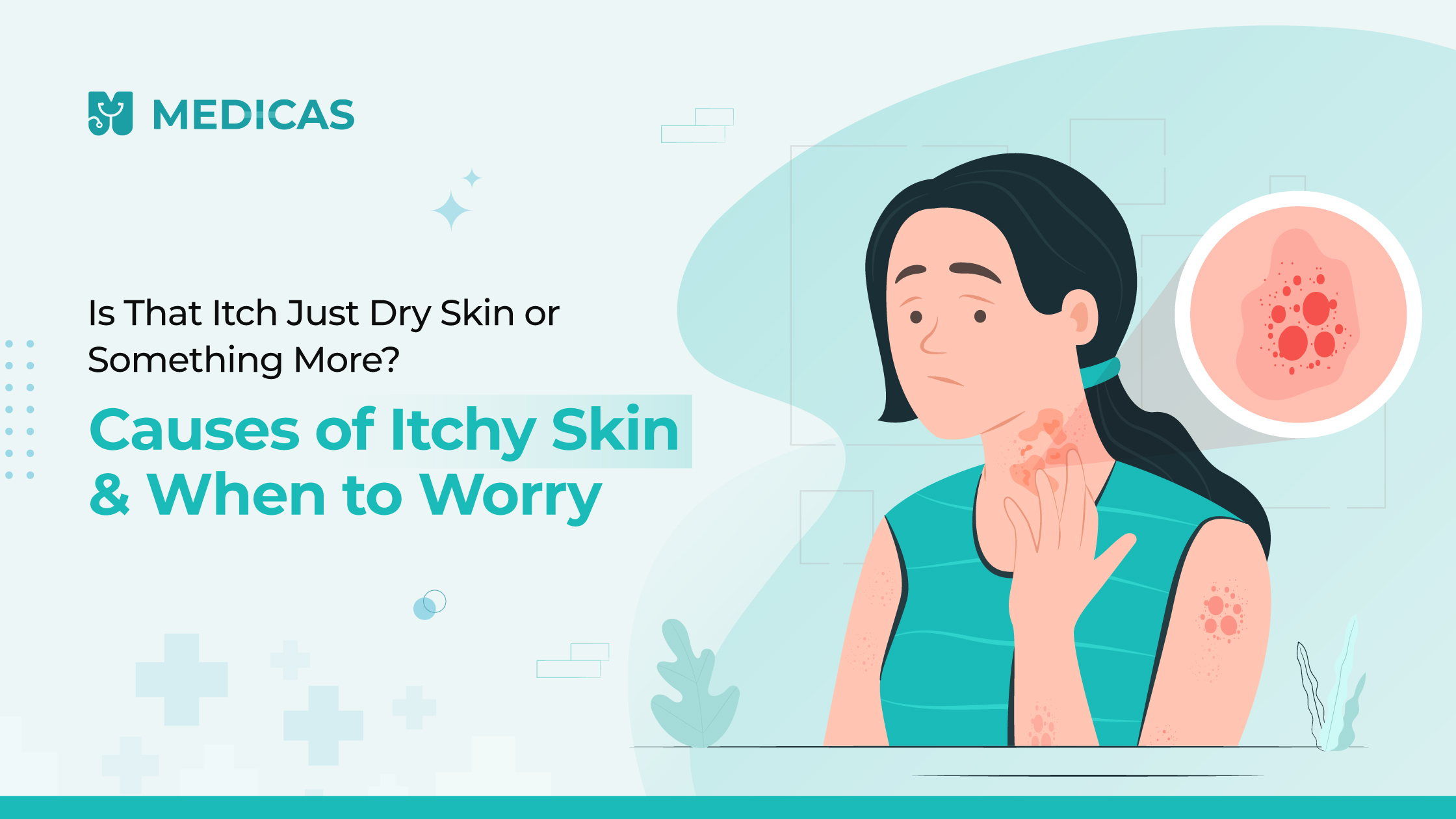 itchy skin